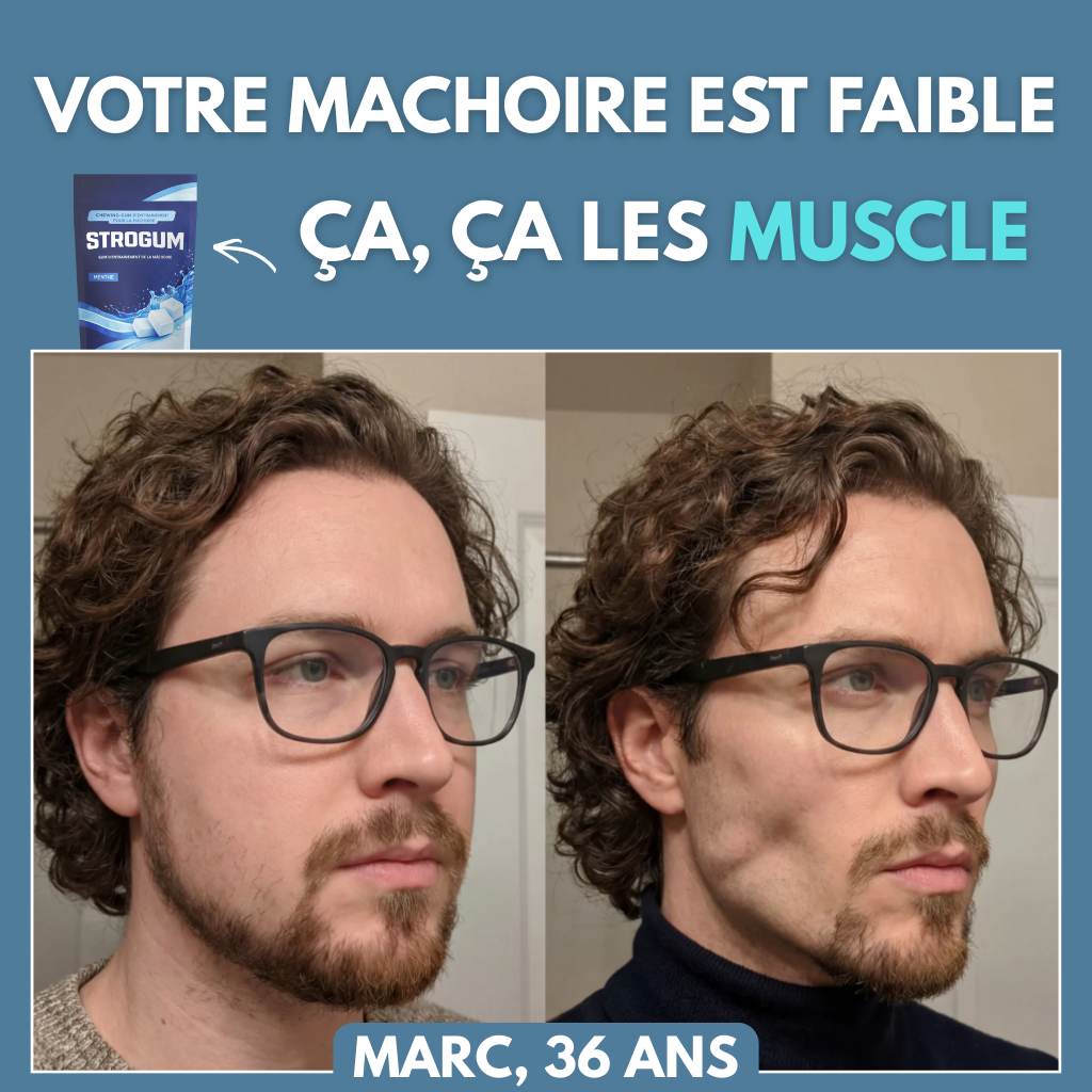 Gommes de définition de la mâchoire et du visage - Strogum®