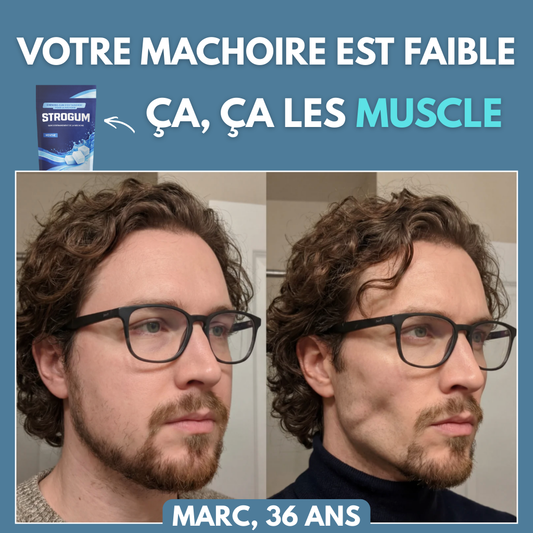 Gommes de définition de la mâchoire et du visage - Strogum®