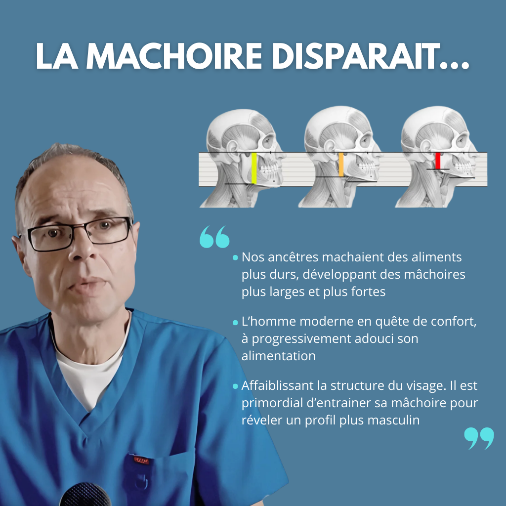 Gommes de définition de la mâchoire et du visage - Strogum®