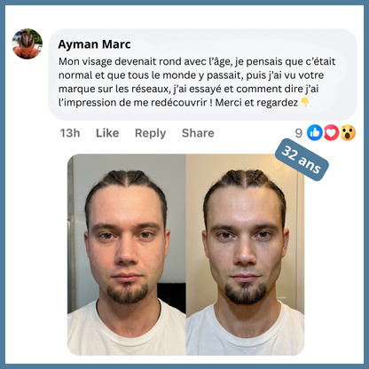 Gommes de définition de la mâchoire et du visage - Strogum®